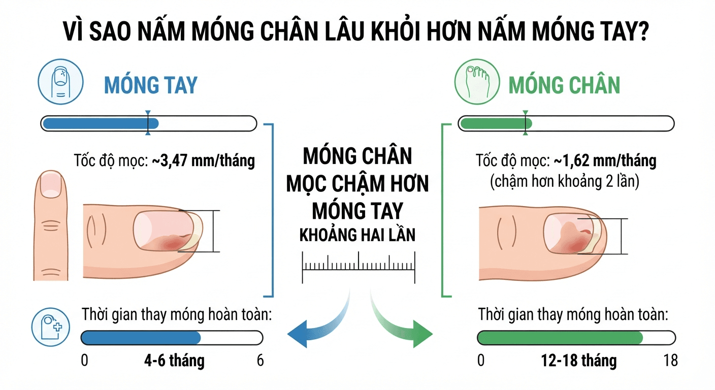 Vì sao nấm móng chân lâu khỏi hơn nấm móng tay?