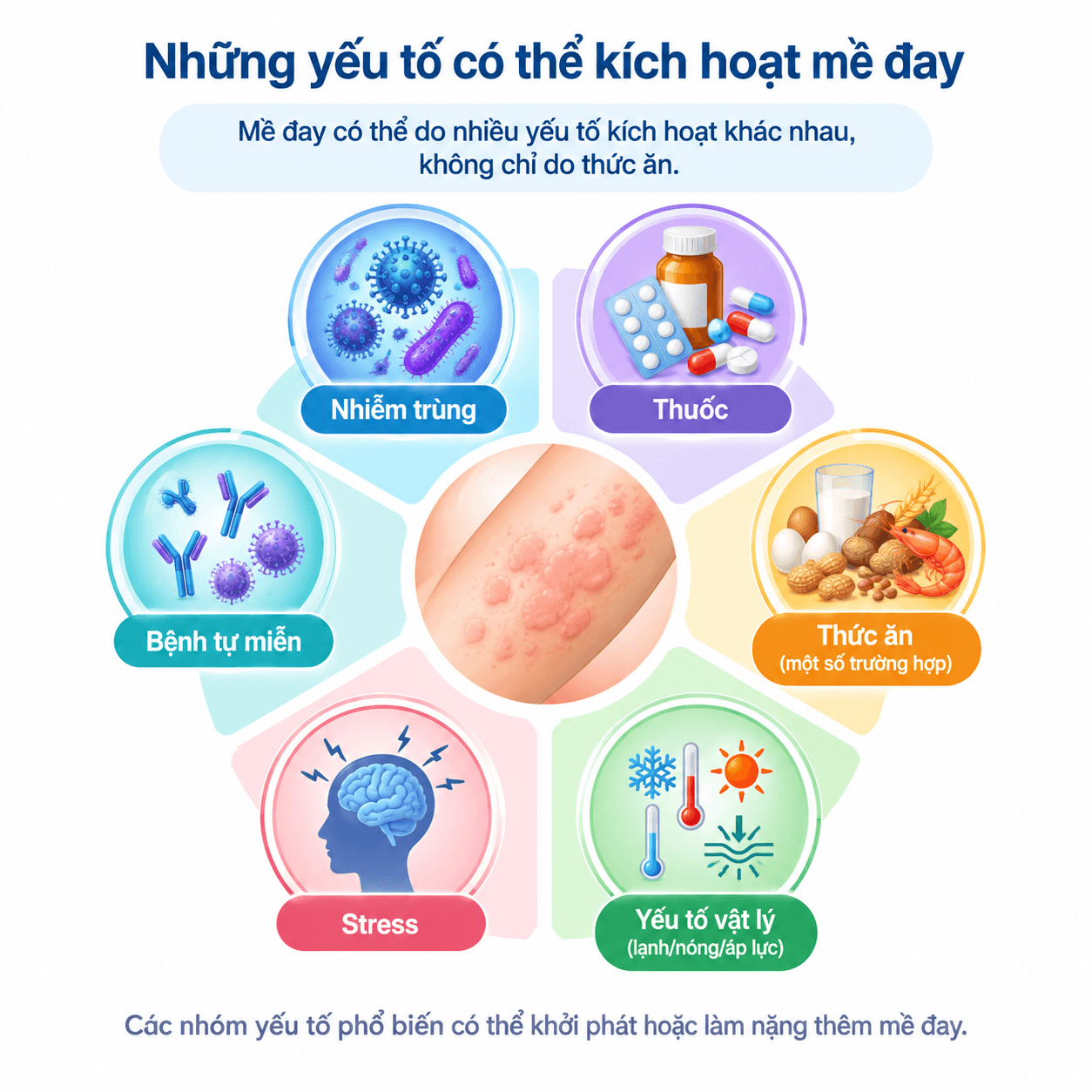 : Infographic các yếu tố kích hoạt bệnh mề đay gồm nhiễm trùng, thuốc, thức ăn, yếu tố vật lý và stress.