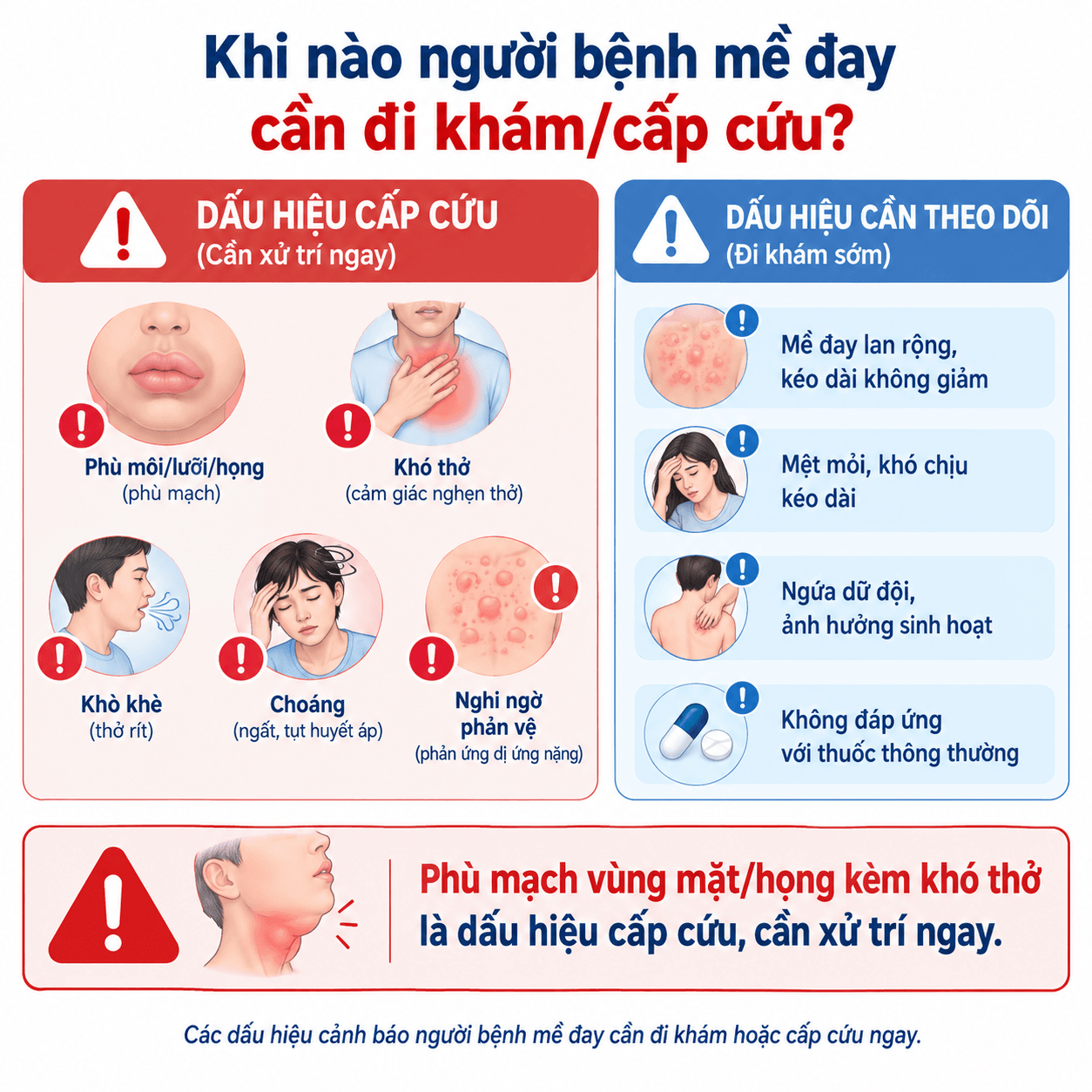 Infographic dấu hiệu cảnh báo cần cấp cứu ở bệnh nhân mề đay và phù mạch.