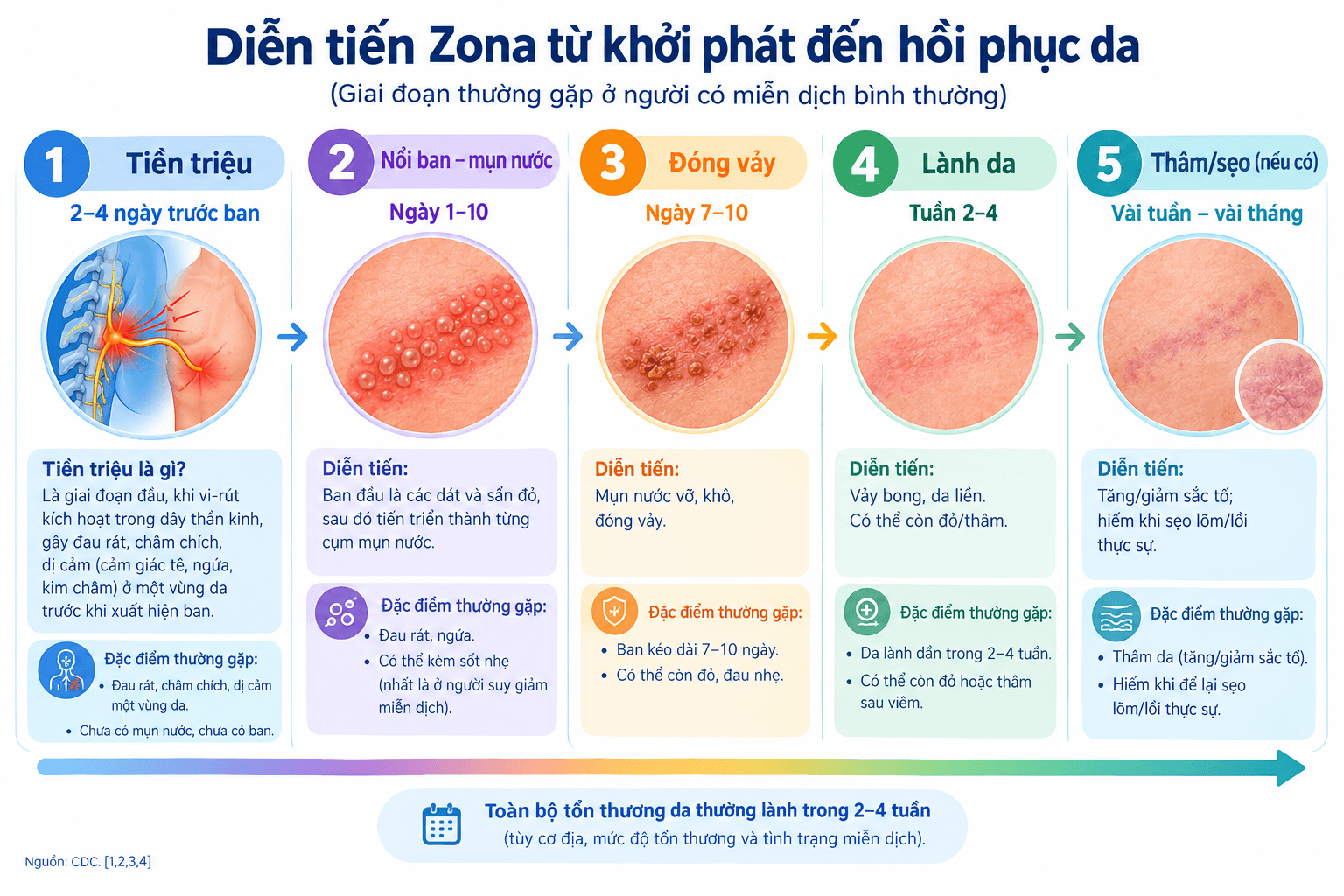 Infographic timeline diễn tiến bệnh Zona thần kinh từ tiền triệu đến lành da 2-4 tuần.