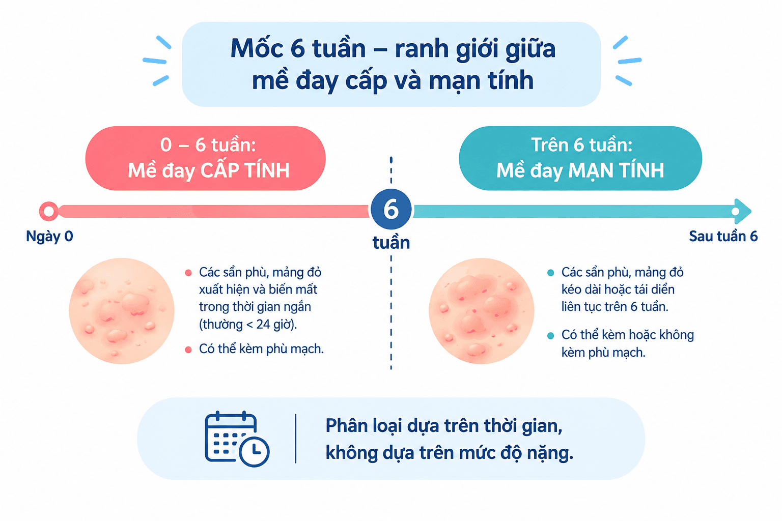Mốc 6 tuần – ranh giới giữa mề đay cấp và mạn tính